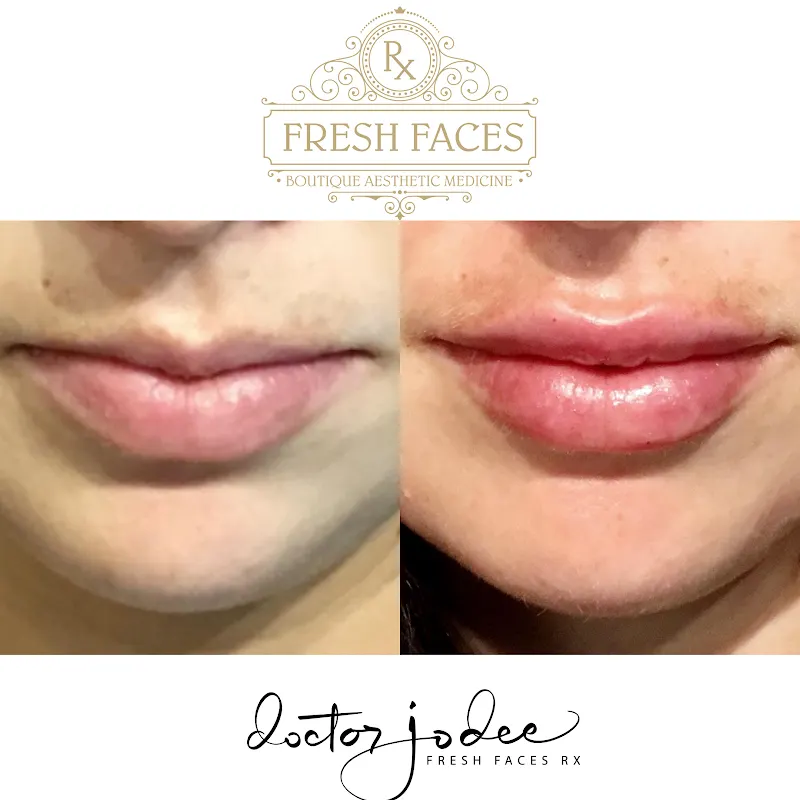 Fresh Faces RX | Advanced Aesthetics in Portland | Dr Jodee M Anderson MD — Medical spa in Portland